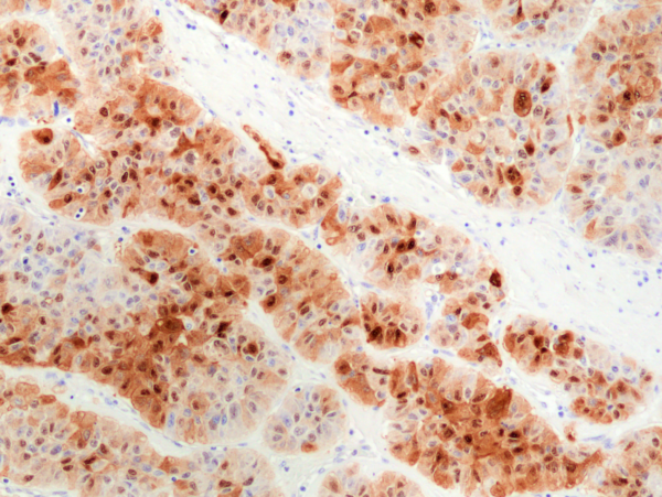 Anti-HSP70 Rabbit Monoclonal Antibody, Clone RM432