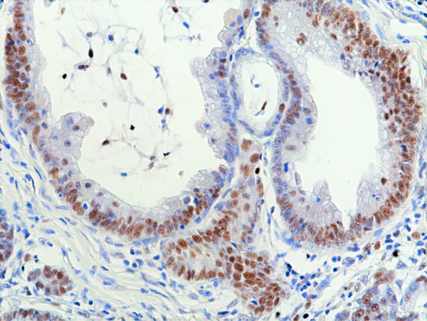 Anti-RNASEH2B Rabbit Monoclonal Antibody, Clone RM433