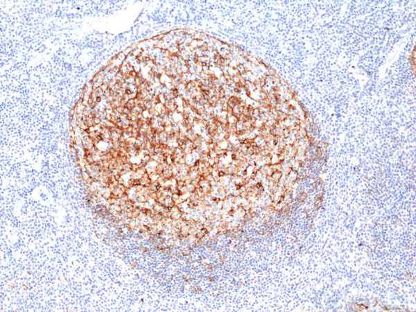 Anti-Clusterin Rabbit Monoclonal Antibody, Clone RM437