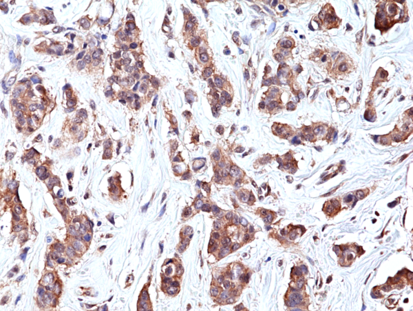 Anti-p70S6K Rabbit Monoclonal Antibody, Clone RM438