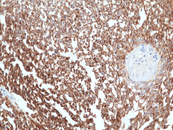 Anti-ANO1 / DOG1 / TMEM16A Rabbit Monoclonal Antibody, Clone RM440