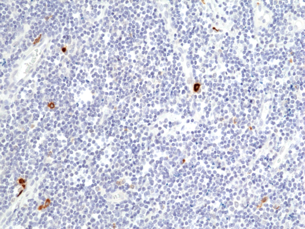 Anti-Granzyme B Rabbit Monoclonal Antibody, Clone RM441