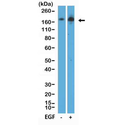 Anti-Phospho-EGFR (Tyr1068) Rabbit Monoclonal Antibody, Clone RM443