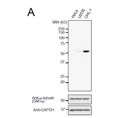 Anti-Detyrosinated alpha-Tubulin Rabbit Monoclonal Antibody, Clone RM444