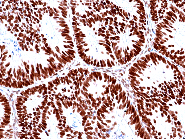 Anti-MSH2 Rabbit Monoclonal Antibody, Clone RM478