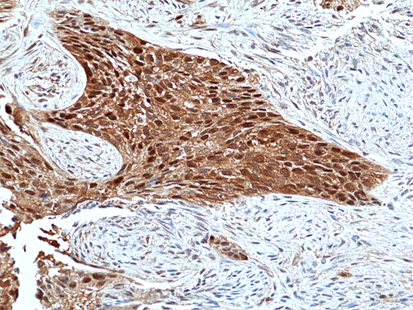 Anti-Erk2 Rabbit Monoclonal Antibody, Clone RM483