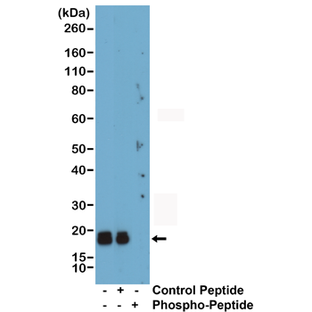 Anti-Phospho-Myl2 (Myosin Light Chain 2v) (Ser19) Rabbit Monoclonal Antibody, Clone RM484