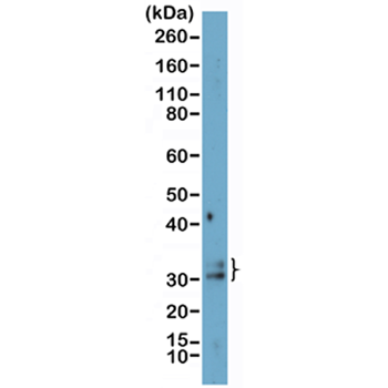 Anti-DDIT3 Rabbit Monoclonal Antibody, Clone RM485
