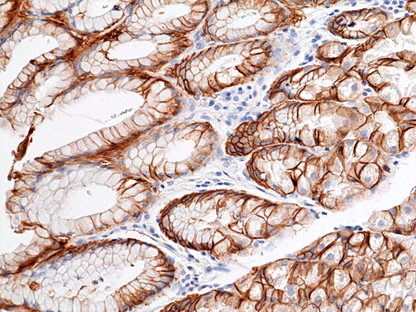 Anti-CAIX(CA9) Rabbit Monoclonal Antibody, Clone RM486
