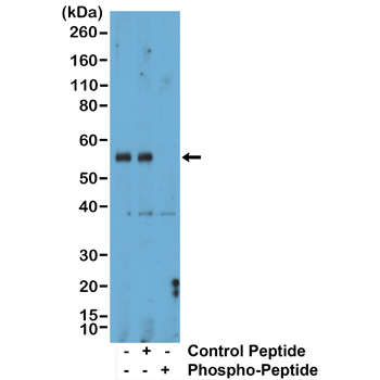 Anti-Phospho-Smad1 (Ser463/465)/ Smad5 (Ser463/465)/ Smad9 (Ser465/467)  Rabbit Monoclonal Antibody, Clone RM487