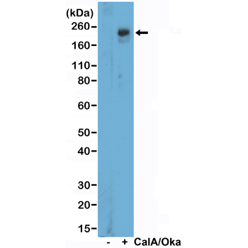 Anti-Phospho-ULk1 (Autophagy-related protein 1 homolog, ATG1) (Ser757) Rabbit Monoclonal Antibody, Clone RM488