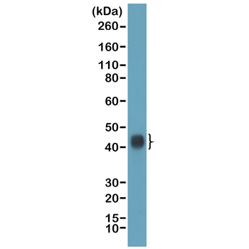 Anti-TIA1 (T-cell-restricted intracellular antigen-1) Rabbit Monoclonal Antibody, Clone RM490