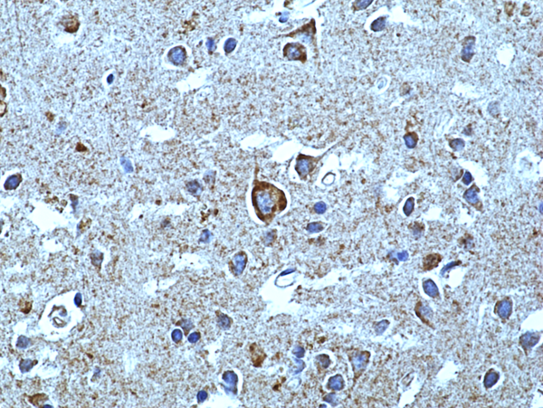 Anti-Alpha-synuclein (SYUA) Rabbit Monoclonal Antibody, Clone RM492