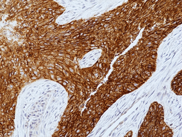 Anti-EGFR (EGF Receptor) Rabbit Monoclonal Antibody, Clone RM493