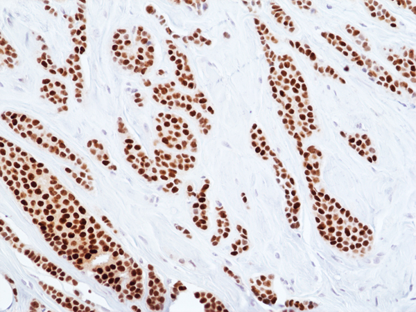 Anti-ER-alpha (Estrogen receptor) Rabbit Monoclonal Antibody, Clone RM494
