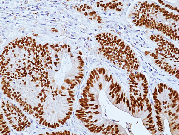 Anti-CDX2 Rabbit Monoclonal Antibody, Clone RM495
