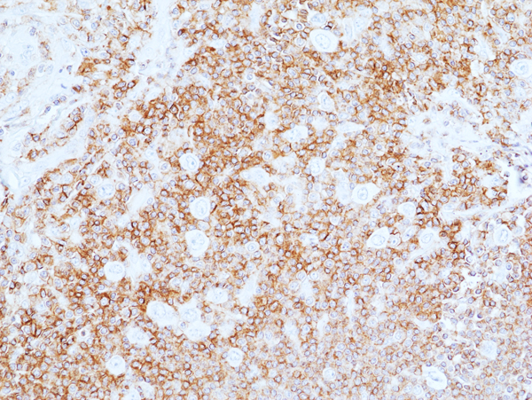 Anti-CD45 Rabbit Monoclonal Antibody, Clone RM497