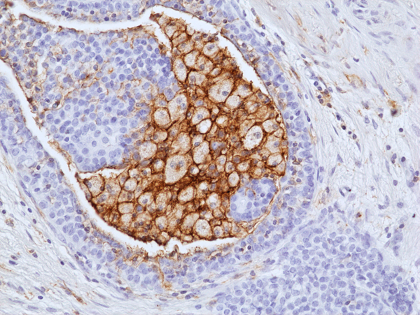 Anti-LAIR1 Rabbit Monoclonal Antibody, Clone RM498