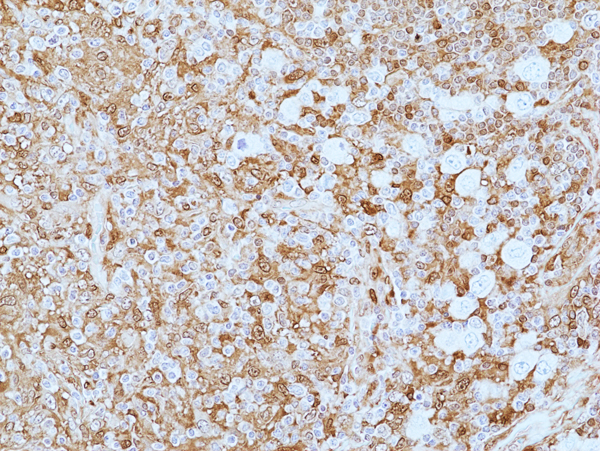 Anti-Gal-9 (Galectin-9) Rabbit Monoclonal Antibody, Clone RM499