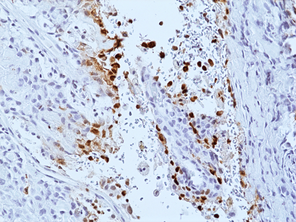 Anti-Phospho-DNA-PKcs (Ser2056) Rabbit Monoclonal Antibody, Clone RM500