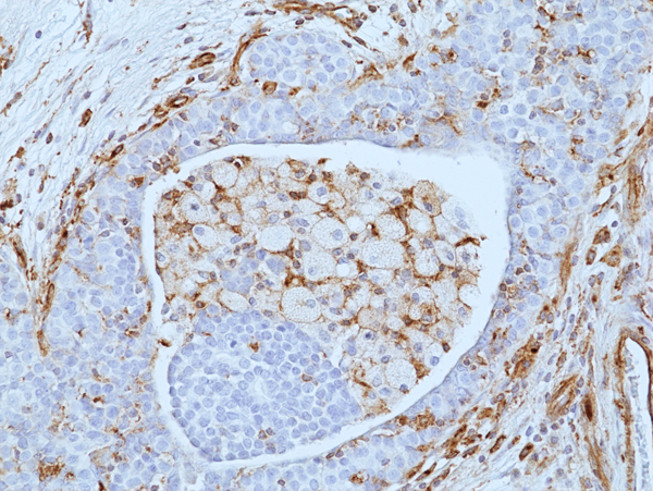 Anti-VISTA Rabbit Monoclonal Antibody, Clone RM503