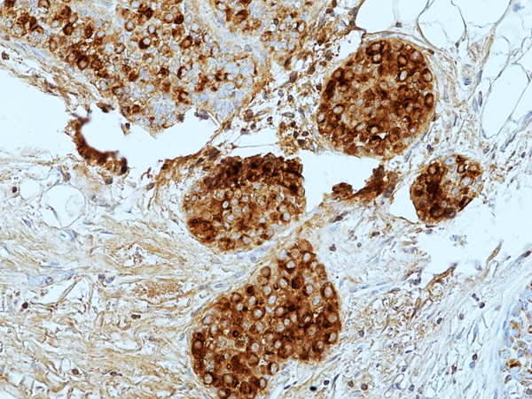 Anti-GCDFP-15 Rabbit Monoclonal Antibody, Clone RM504