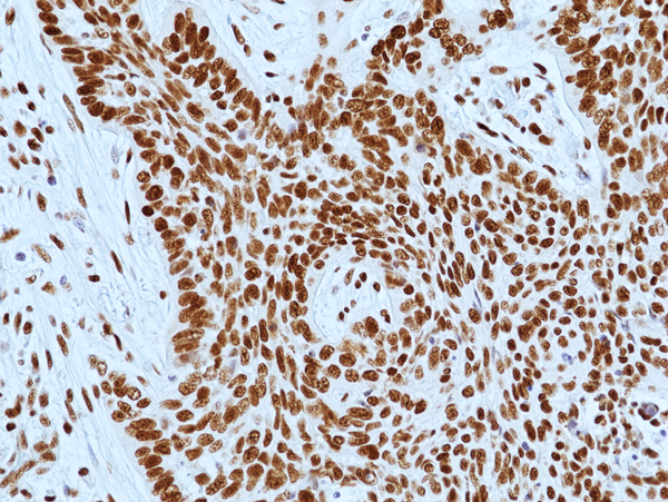 Anti-DNA-PKcs (PRKDC) Rabbit Monoclonal Antibody, Clone RM505