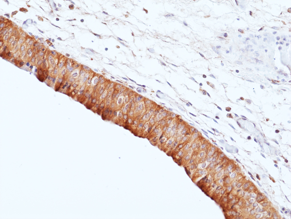 Anti-UP2 (UPII)(Uroplakin-2) Rabbit Monoclonal Antibody, Clone RM507