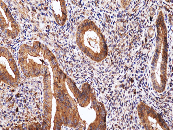 Anti-PTEN Rabbit Monoclonal Antibody, Clone RM511