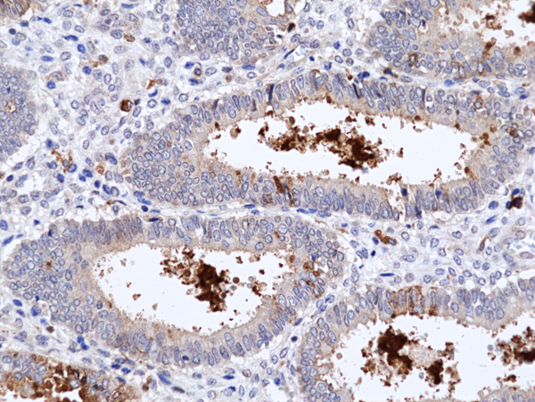 Anti-PTEN Rabbit Monoclonal Antibody, Clone RM511