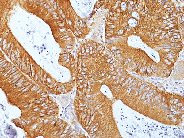 Anti-CD155 (PVR) Rabbit Monoclonal Antibody, Clone RM514