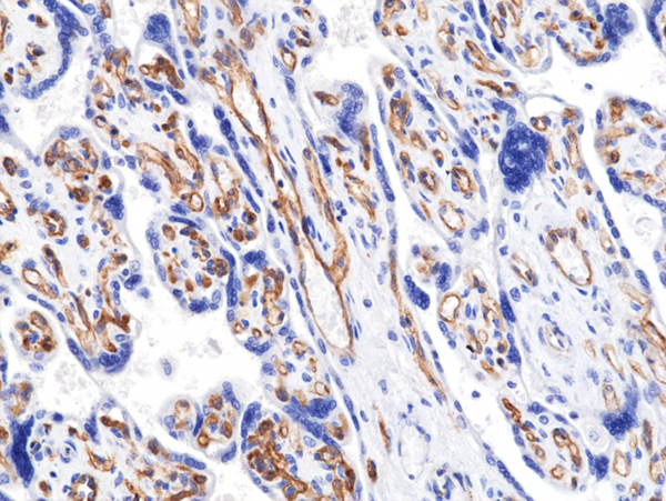 Anti-VEGFR2 (KDR) Rabbit Monoclonal Antibody, Clone RM515