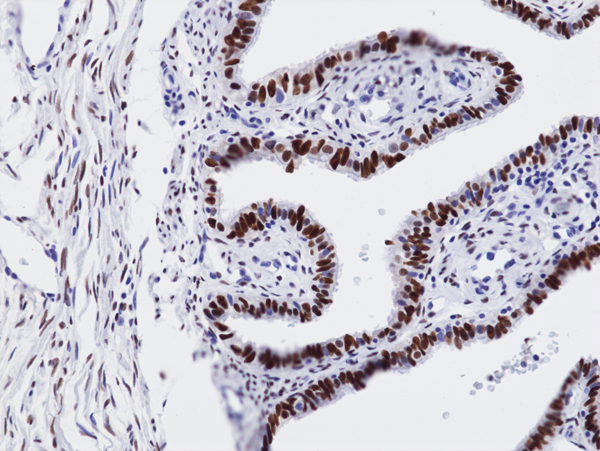 Anti-WT1 Rabbit Monoclonal Antibody, Clone RM516
