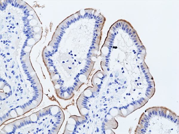 Anti-Muc17 (Mucin-17) Rabbit Monoclonal Antibody, Clone RM517