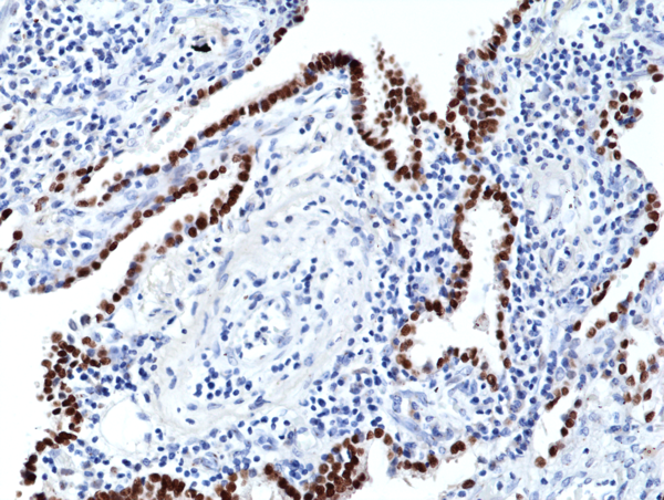 Anti-TTF1 (Thyroid transcription factor 1) Rabbit Monoclonal Antibody, Clone RM373