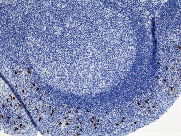 Anti-Human IgA2 Rabbit Monoclonal Antibody, Clone RM125