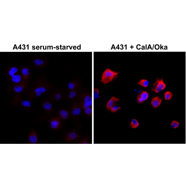 Anti-Phosphothreonine Rabbit Monoclonal Antibody, Clone RM102