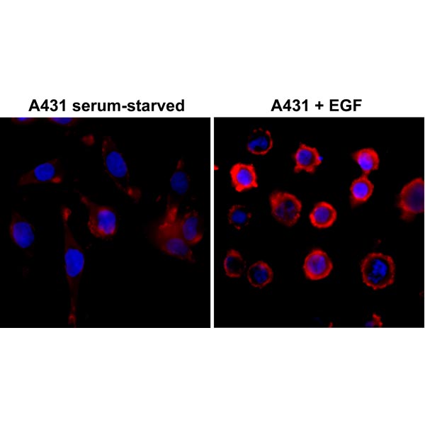Anti-Phosphotyrosine Rabbit Monoclonal Antibody, Clone RM111