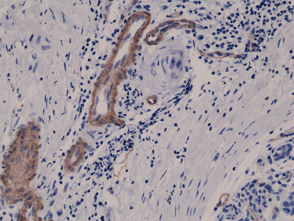 Anti-CD146 Rabbit Monoclonal Antibody, Clone RM249